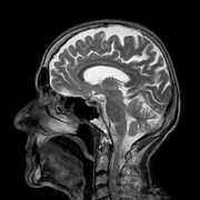 A brain side x-ray